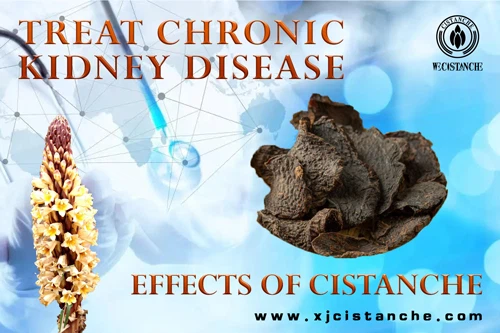 chronic kidney disease
